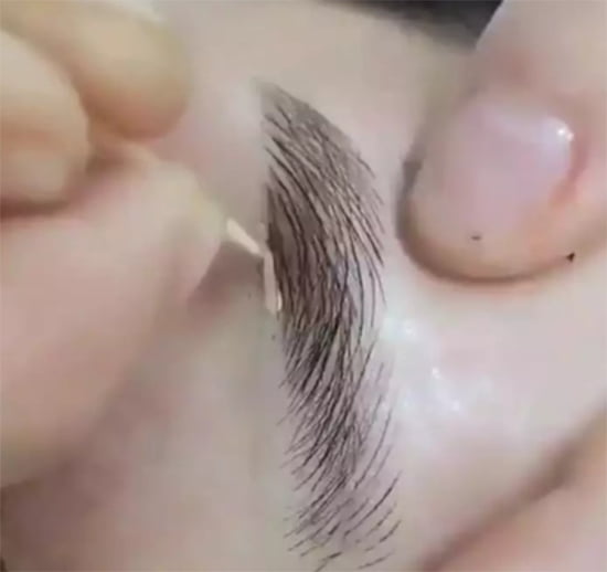 Công dụng của xóa tức thì