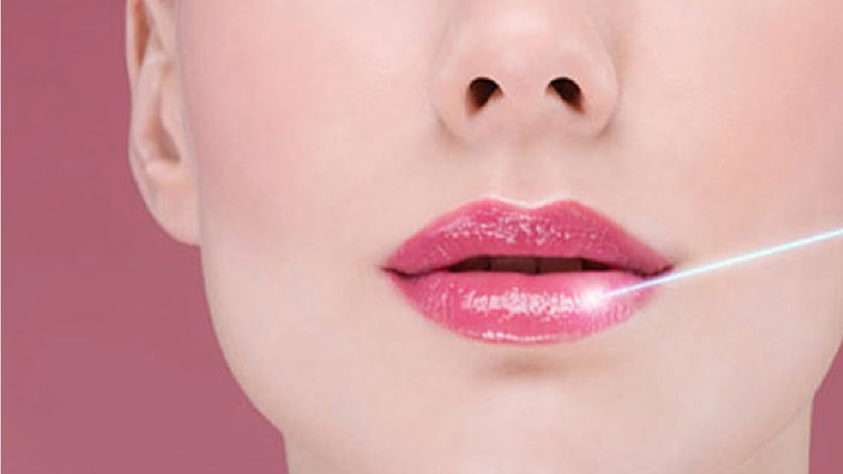 Hướng dẫn sử dụng Collagen PCD để giúp môi phun căng bóng, mịn màng không thương tổn
