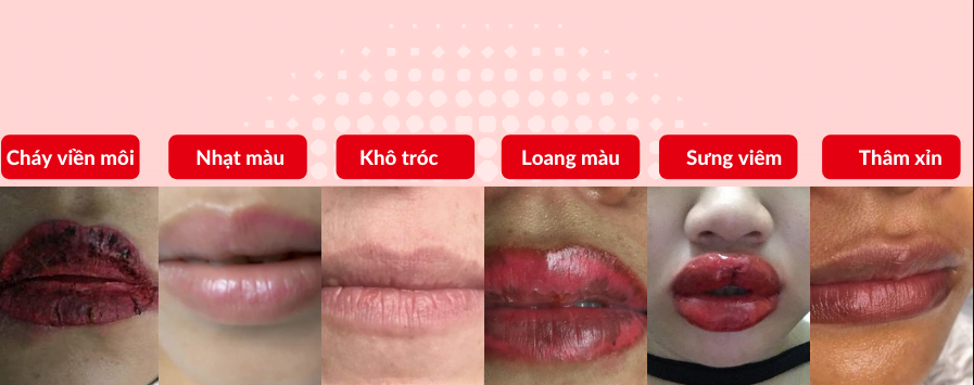 6 trường hợp thợ phun xăm khuyên bạn nên dùng dưỡng kích màu môi Collagen