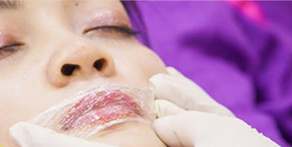 Kinh nghiệm phun môi không đau cho khách hàng