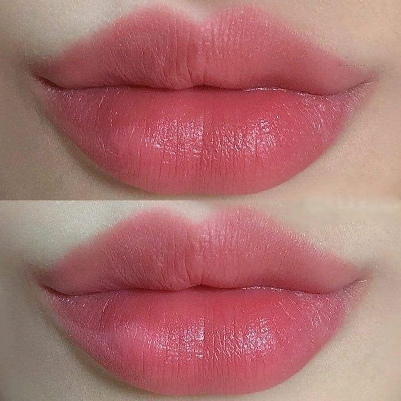 Mực xử lý môi thâm Biotouch