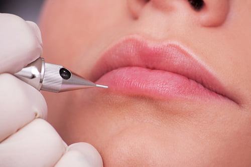 Kim xăm thẩm mỹ có giá bao nhiêu?