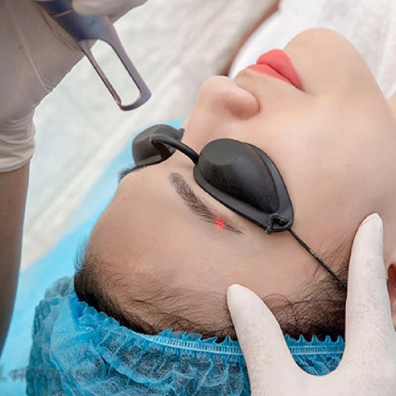 Các phương pháp hút mực hiện nay.